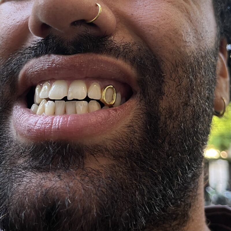 custom gold grillz with gemstones