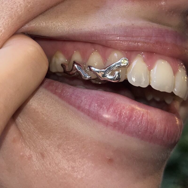 custom silver grillz with gemstones
